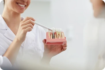 بهترین روکش ایمپلنت چیست؟